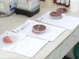 Three samples from 3 patients plated on culture media to identify bacteria in the CSREF laboratory in Koutiala, Mali.