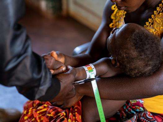 Mother holds child during malnutrition screening in Angola